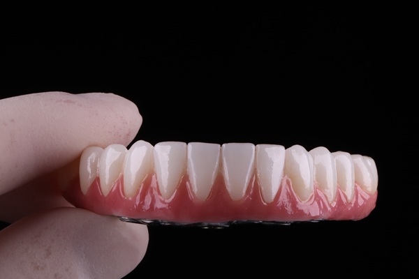 Common Issues With All On Implants And How To Avoid Them