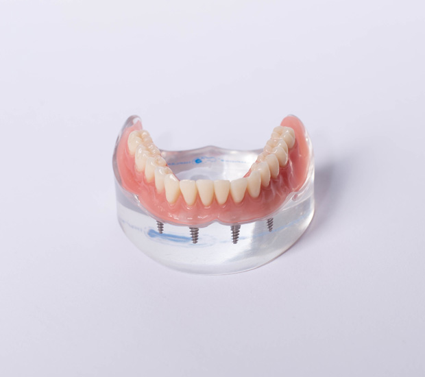 West Bloomfield Township All-on-4®