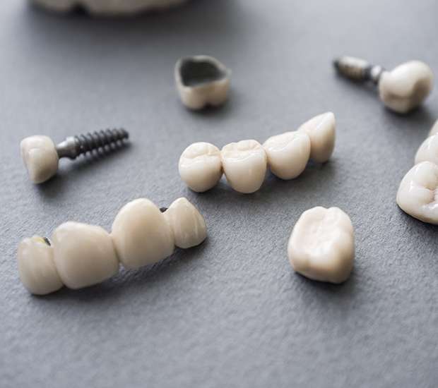 West Bloomfield Township The Difference Between Dental Implants and Mini Dental Implants