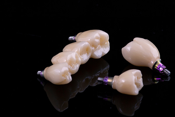 Replace Missing Teeth With Dental Implants