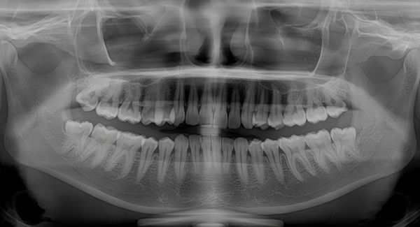Experiencing Jaw Pain? Find The Right TMJ Treatment For You