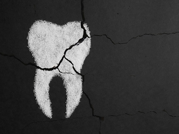 Tooth Decay West Bloomfield Township, MI